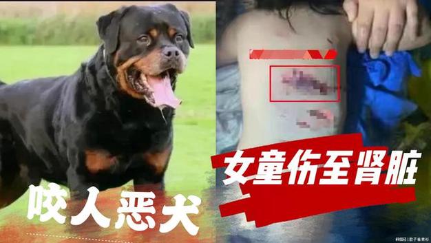 如何看待西乡县城北社区24小时内7人被恶犬咬伤「疾控部回应蟑螂进化的问题」 太阳能工程